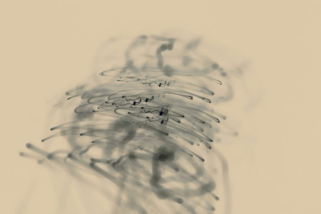 Abstrakte graue Linien als Bild für eine Krebsdiagnose als Trauma